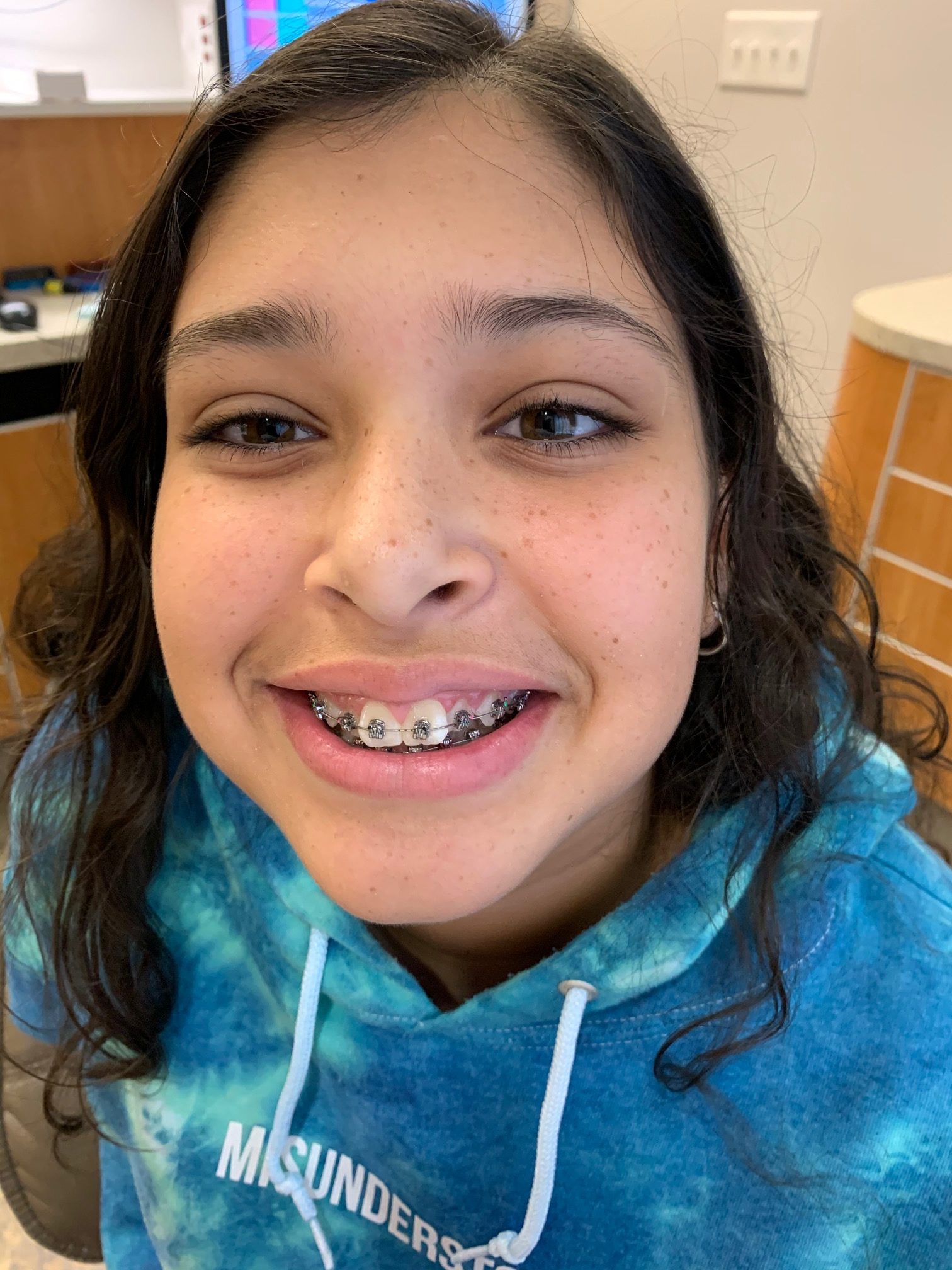How Much Do Teeth Braces Cost with Insurance?